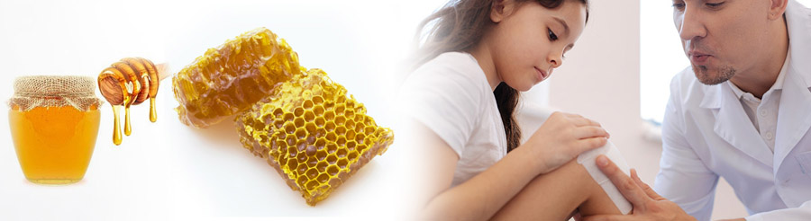 درمان زخم با عسل